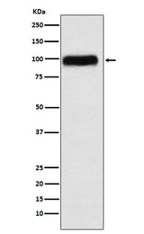 Anti-SERPING1 Rabbit Monoclonal Antibody Boster Bio