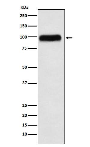 Anti-SERPING1 Rabbit Monoclonal Antibody Boster Bio