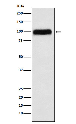 Anti-SERPING1 Rabbit Monoclonal Antibody Boster Bio