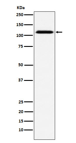 Anti-CD30 Rabbit Monoclonal Antibody Boster Bio