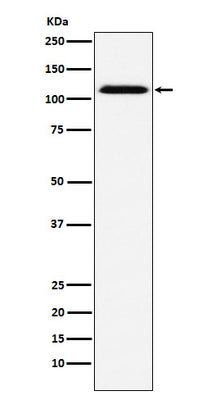 Anti-CD30 Rabbit Monoclonal Antibody Boster Bio