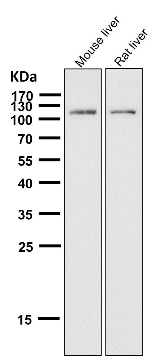 Anti-ABCG1 Rabbit Monoclonal Antibody Boster Bio