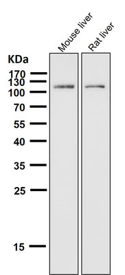 Anti-ABCG1 Rabbit Monoclonal Antibody Boster Bio