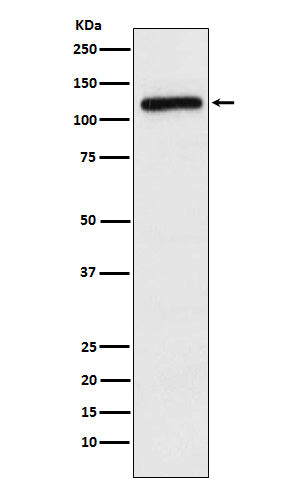 Anti-APLP2 Rabbit Monoclonal Antibody Boster Bio