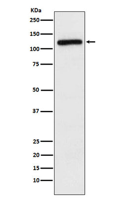 Anti-APLP2 Rabbit Monoclonal Antibody Boster Bio