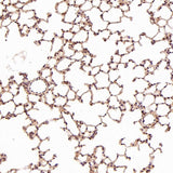 Anti-TSG101 Rabbit Monoclonal Antibody Boster Bio