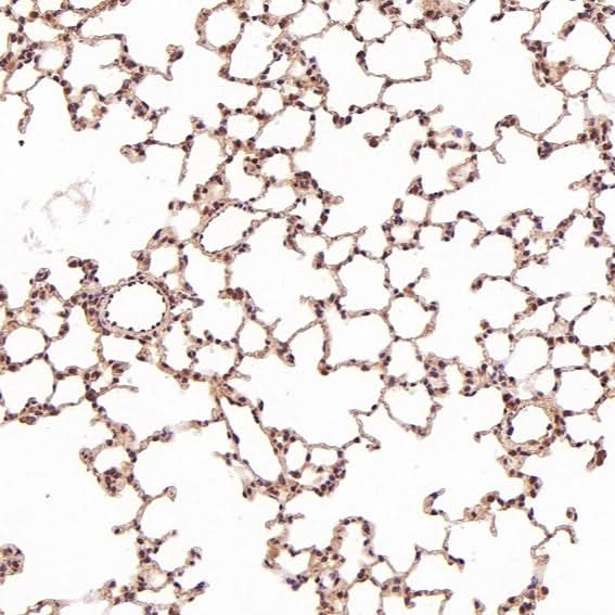 Anti-TSG101 Rabbit Monoclonal Antibody Boster Bio