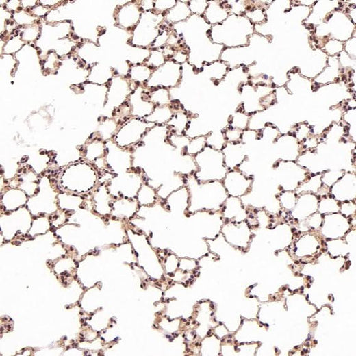 Anti-TSG101 Rabbit Monoclonal Antibody Boster Bio