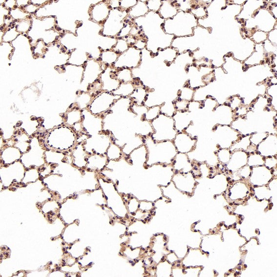 Anti-TSG101 Rabbit Monoclonal Antibody Boster Bio