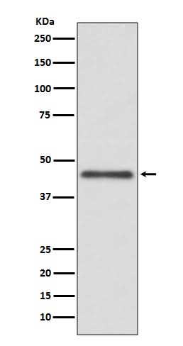 Anti-HLA G Rabbit Monoclonal Antibody Boster Bio