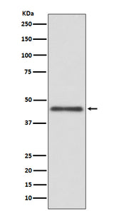 Anti-HLA G Rabbit Monoclonal Antibody Boster Bio