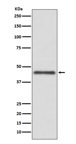 Anti-HLA G Rabbit Monoclonal Antibody Boster Bio