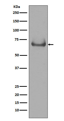 Anti-Lamin B Receptor LBR Rabbit Monoclonal Antibody Boster Bio