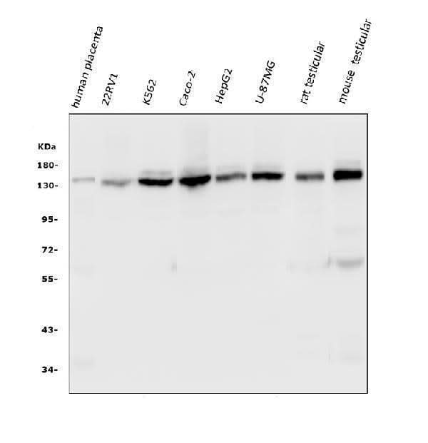 Anti-HAUSP/USP7 Antibody Picoband® (monoclonal, 5E2 Boster Bio