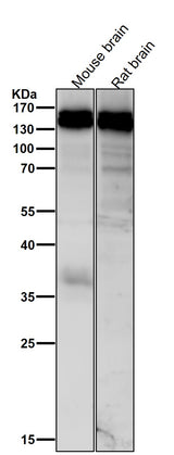 Anti-HAUSP / USP7 Rabbit Monoclonal Antibody Boster Bio