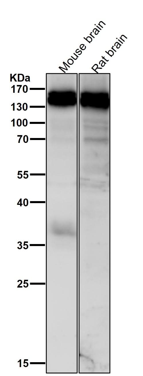 Anti-HAUSP / USP7 Rabbit Monoclonal Antibody Boster Bio