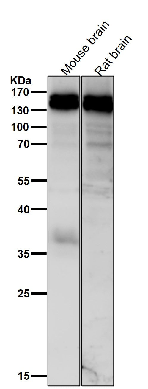 Anti-HAUSP / USP7 Rabbit Monoclonal Antibody Boster Bio