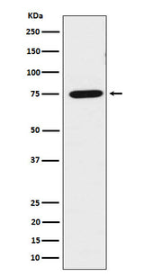 Anti-LPP Rabbit Monoclonal Antibody Boster Bio