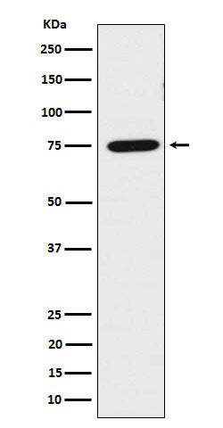 Anti-LPP Rabbit Monoclonal Antibody Boster Bio