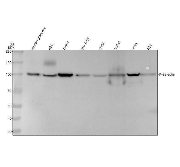 Anti-CD62P SELP Rabbit Monoclonal Antibody Boster Bio