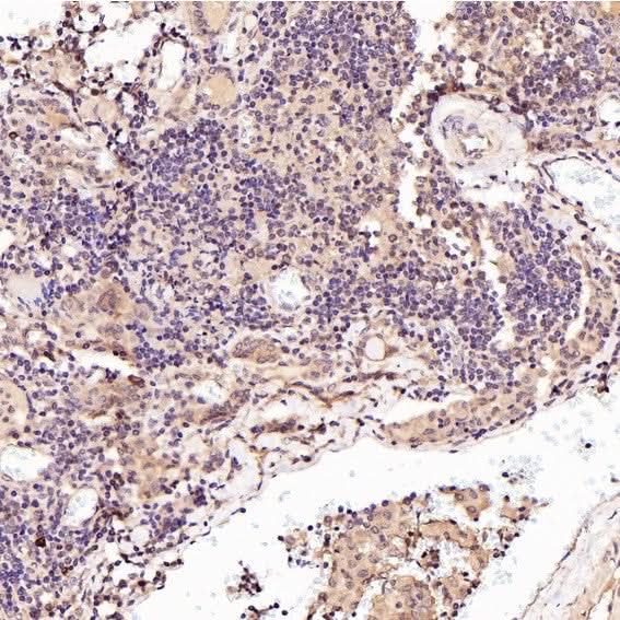 Anti-p57 Kip2 Rabbit Monoclonal Antibody Boster Bio