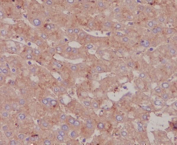 Anti-Albumin Rabbit Monoclonal Antibody Boster Bio