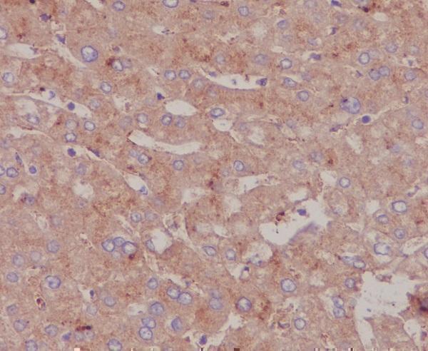 Anti-Albumin Rabbit Monoclonal Antibody Boster Bio