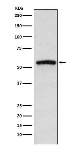 Anti-IRAK4 Monoclonal Antibody Boster Bio