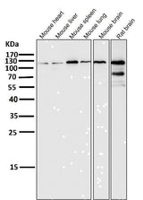 Anti-HIF-2 alpha EPAS1 Rabbit Monoclonal Antibody Boster Bio