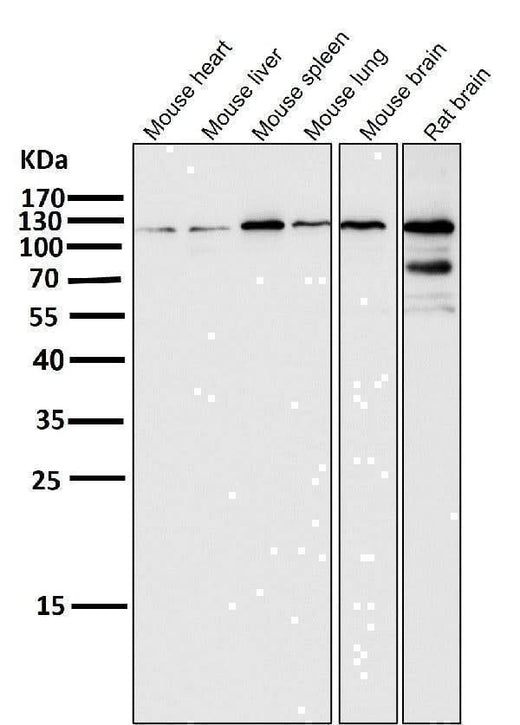 Anti-HIF-2 alpha EPAS1 Rabbit Monoclonal Antibody Boster Bio