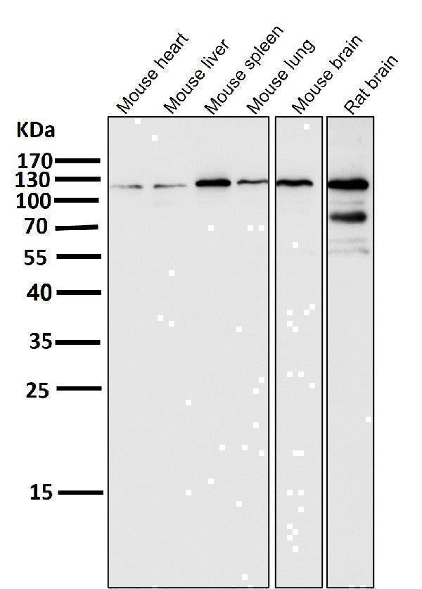 Anti-HIF-2 alpha EPAS1 Rabbit Monoclonal Antibody Boster Bio