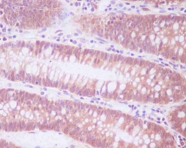 Anti-ENO1/Alpha Enolase Rabbit Monoclonal Antibody Boster Bio