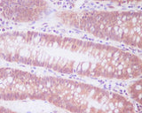 Anti-ENO1/Alpha Enolase Rabbit Monoclonal Antibody Boster Bio