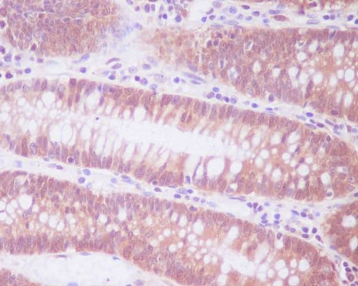 Anti-ENO1/Alpha Enolase Rabbit Monoclonal Antibody Boster Bio