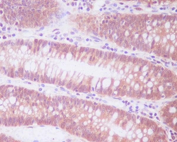 Anti-ENO1/Alpha Enolase Rabbit Monoclonal Antibody Boster Bio