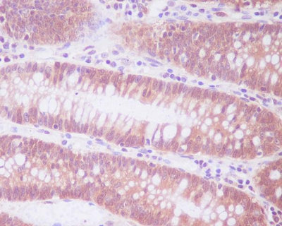 Anti-ENO1/Alpha Enolase Rabbit Monoclonal Antibody Boster Bio