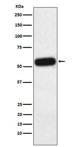 Anti-Fetuin A Rabbit Monoclonal Antibody Boster Bio