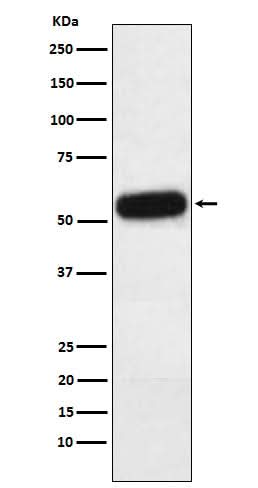 Anti-Fetuin A Rabbit Monoclonal Antibody Boster Bio