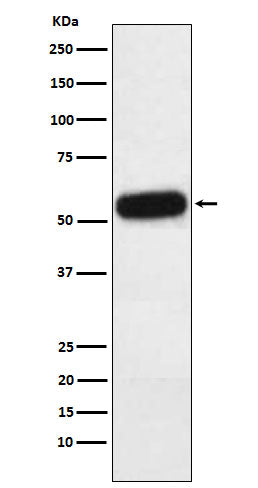 Anti-Fetuin A Rabbit Monoclonal Antibody Boster Bio