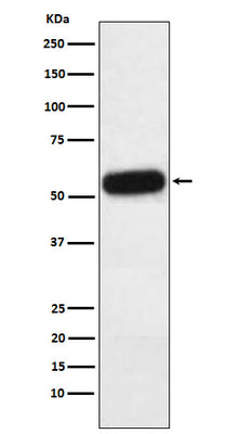 Anti-Fetuin A Rabbit Monoclonal Antibody Boster Bio