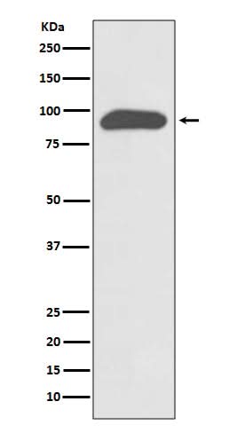 Anti-Chromogranin A CHGA Rabbit Monoclonal Antibody Boster Bio