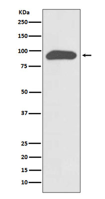 Anti-Chromogranin A CHGA Rabbit Monoclonal Antibody Boster Bio