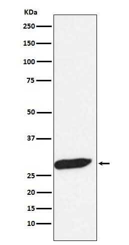 Anti-FHL1 Monoclonal Antibody Boster Bio