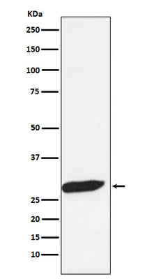 Anti-FHL1 Monoclonal Antibody Boster Bio
