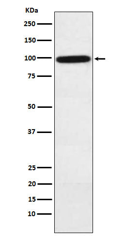 Anti-Complement factor B Rabbit Monoclonal Antibody Boster Bio