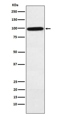 Anti-Complement factor B Rabbit Monoclonal Antibody Boster Bio