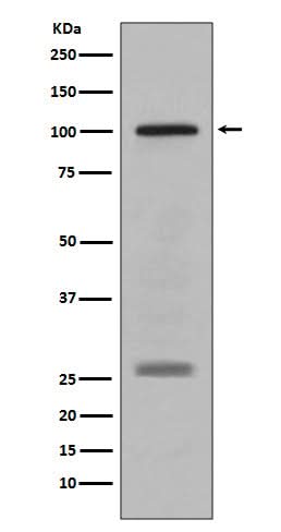 Anti-PMEL17 / GP100 Rabbit Monoclonal Antibody Boster Bio