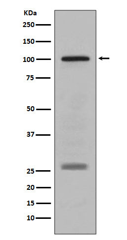 Anti-PMEL17 / GP100 Rabbit Monoclonal Antibody Boster Bio