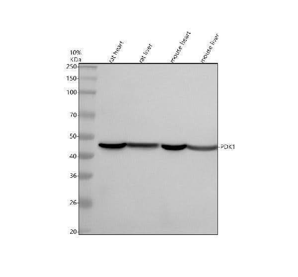 Anti-PDK1 Monoclonal Antibody Boster Bio