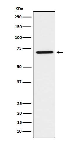 Anti-HNF1 beta Rabbit Monoclonal Antibody Boster Bio